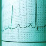 Withings ScanWatch Horizon Review (USA): The Best Luxury Hybrid For Discreet Medical-Grade Heart Health Tracking? - Product Review