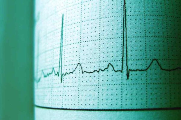 Withings ScanWatch Horizon Review (USA): The Best Luxury Hybrid For Discreet Medical-Grade Heart Health Tracking? - Product Review